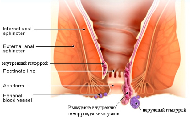 Деликатная проблема: геморрой. Проктологические салфетки Хелпо-Хемор.